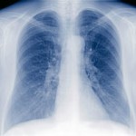 Love your lungs as well as your heart