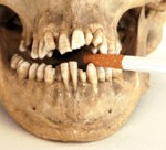 Smoking attacks teeth and gums