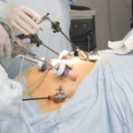 Weight loss surgery has evolved to hypnosis surgery?