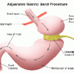 What if hypnosis could simulate this surgery?
